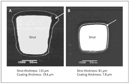 Paclitaxel-Eluting Stent and an Everolimus-Eluting Stent