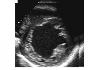 Ahmad_football_ECHO image