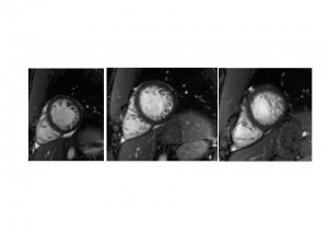 Ahmad_football_MRI image Football_Player_MRI