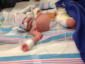 baby in the NICU