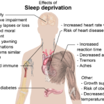 sleep deprivation effects